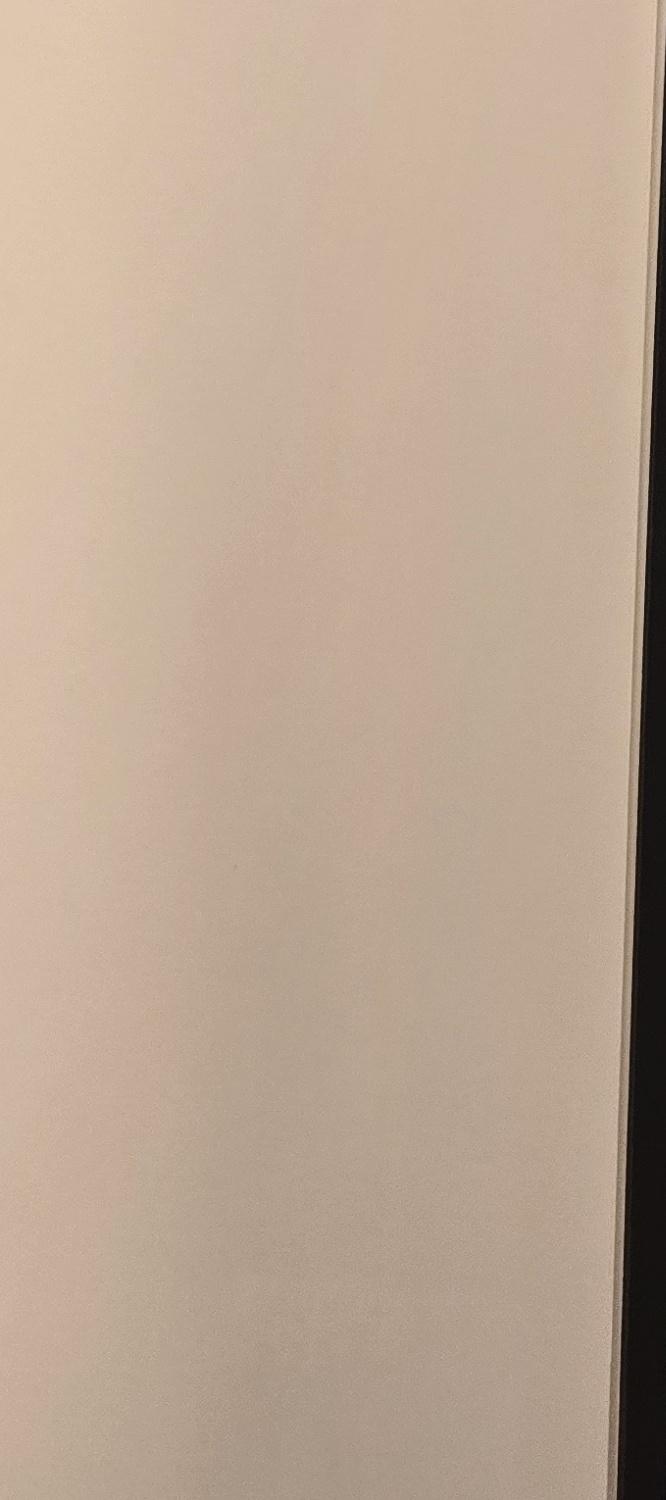아말감 교체 시기 이렇게 따져보세요 관련 이미지 22