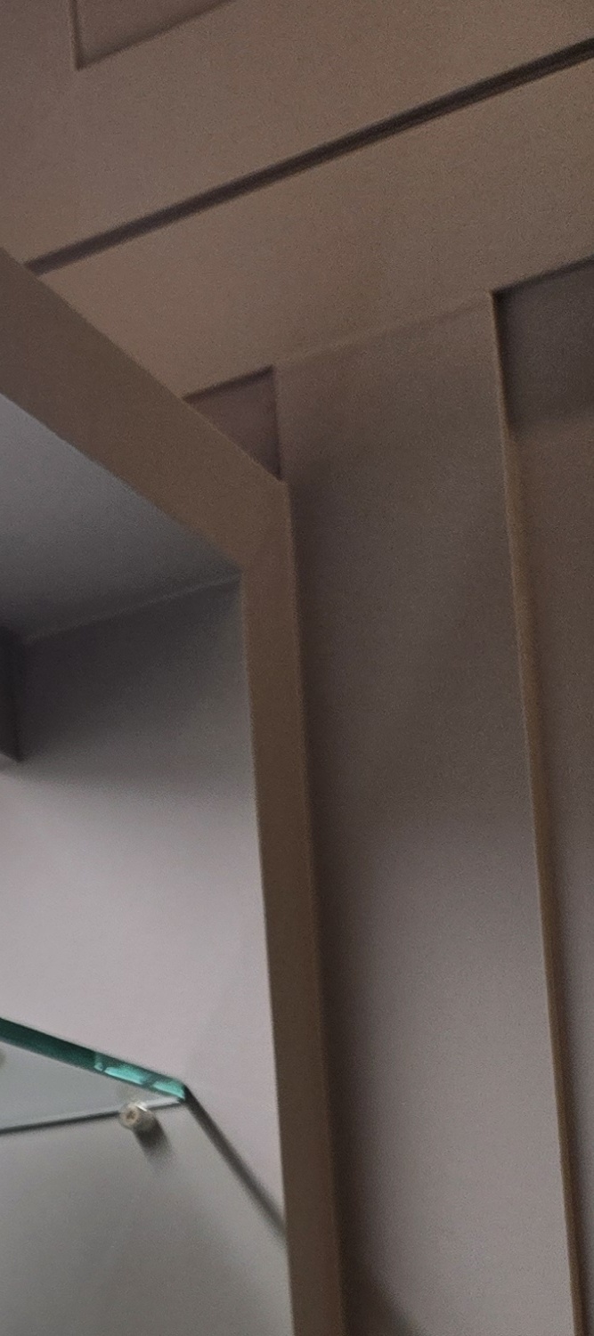 어금니 임플란트 통증 어렵게 느껴진다면 관련 이미지 33