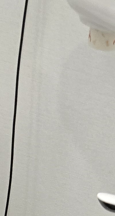 치아 사이 벌어짐 심해지는 이유부터 알아보면 관련 이미지 15