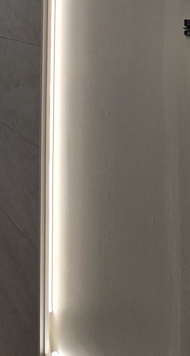 과개교합 교정 후 얼굴형 얼마나 바뀌나요 관련 이미지 20