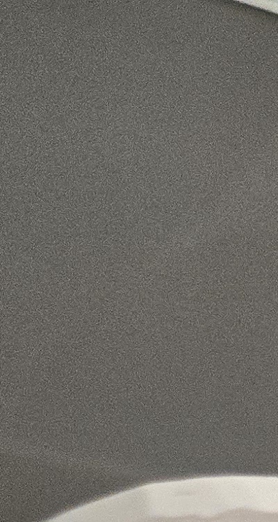 사랑니 주변 잇몸 통증 지금부터가 중요하니까 관련 이미지 13