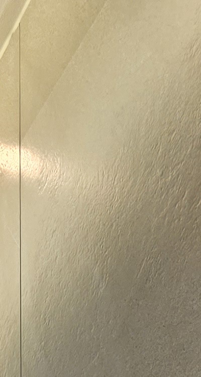 반대교합 치아교정 해결 가능할까 관련 이미지 13