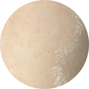 피부붉은자국 가만히두시면 안되죠~ 관련 이미지 7