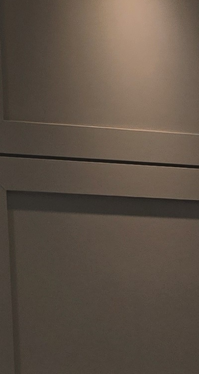 반대교합 치아교정 해결 가능할까 관련 이미지 34