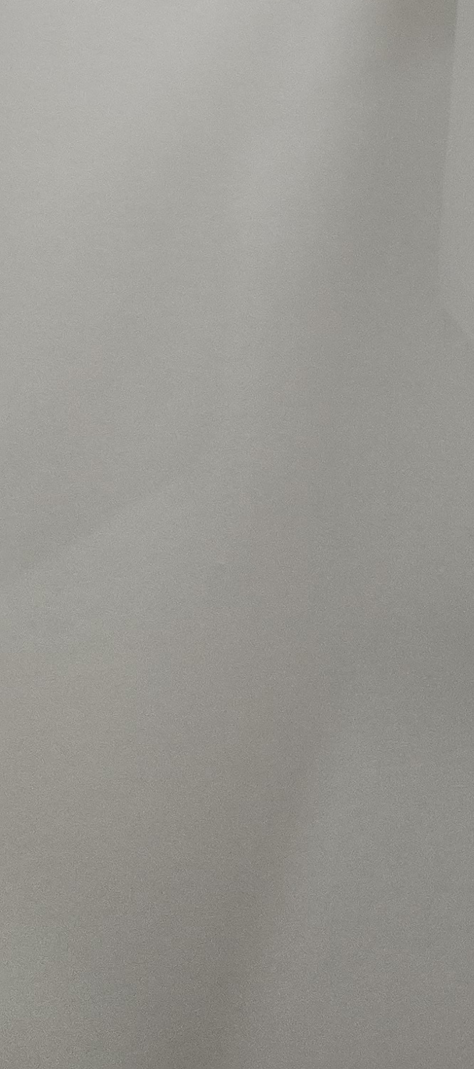 벌어진 앞니 교정 체계적으로 대비하려면 관련 이미지 30
