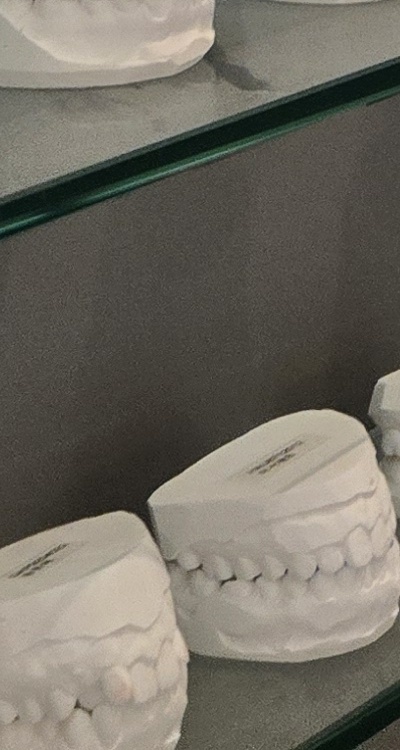 완전매복사랑니 발치 대학병원 꼭 가야하나요 관련 이미지 43