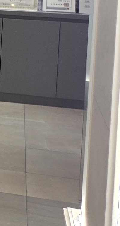 임플란트의 장점 할까 말까 고민이신 분들을 위한 정리 관련 이미지 39