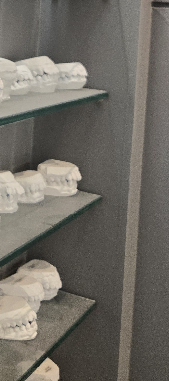 오래된 보철물 아말감 교체 어떠한 케이스일까 관련 이미지 20