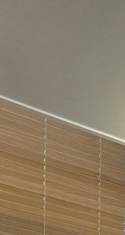 돌출입 팔자주름 교정 얼마나 바뀔까요 관련 이미지 14