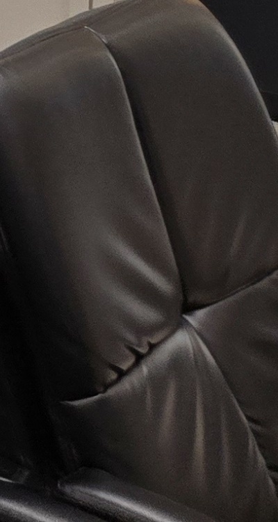 돌출입 팔자주름 교정 얼마나 바뀔까요 관련 이미지 50