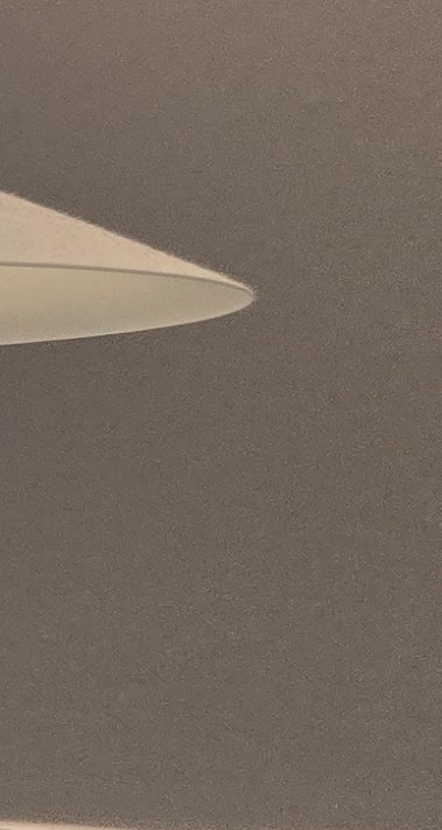 인레이 치료 후 통증 자꾸 심해지는데 괜찮은걸까 관련 이미지 40