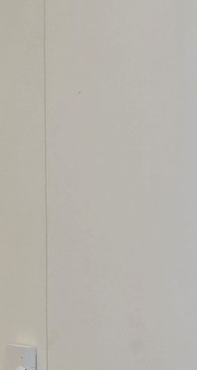 앞니 부분 교정 간단하니까 좋은건가요 관련 이미지 28