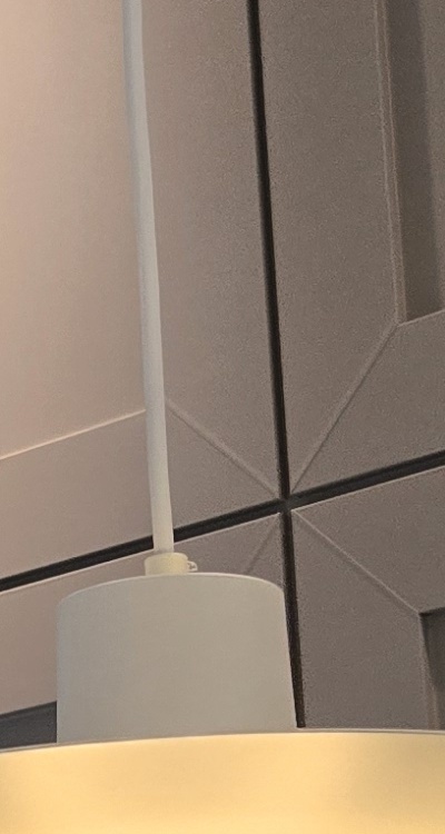 인레이 치료 후 통증 자꾸 심해지는데 괜찮은걸까 관련 이미지 28