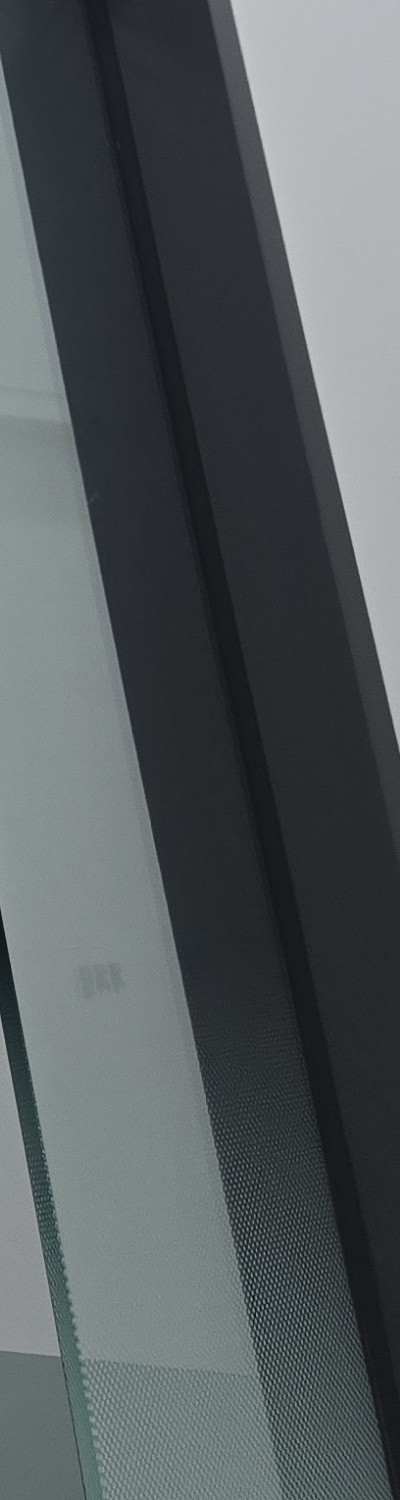 앞니 크라운 교체 깔끔하게 정리하려면 관련 이미지 27