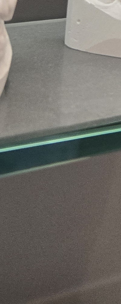 어르신 임플란트 지원 현명하게 활용하려면 관련 이미지 35