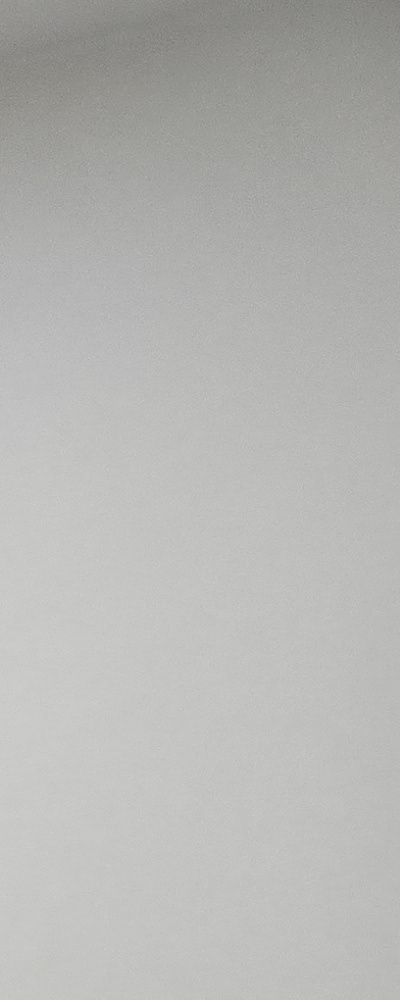 인레이 치료 후 신경치료 이유가 궁금하다면 관련 이미지 22