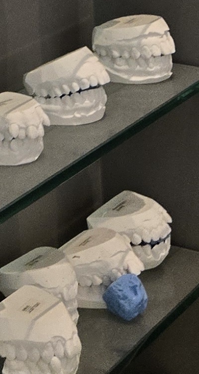 완전매복사랑니 발치 대학병원 꼭 가야하나요 관련 이미지 45