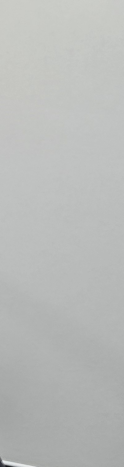 치과 치아미백 효과 어떤식으로 나타날까 관련 이미지 16