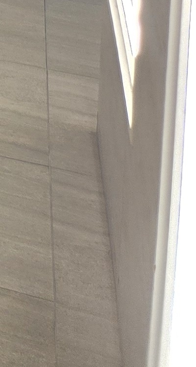 임플란트의 장점 할까 말까 고민이신 분들을 위한 정리 관련 이미지 49