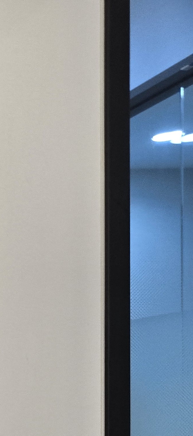 어금니 임플란트 과정 기간 어느정도 예상되나요 관련 이미지 17