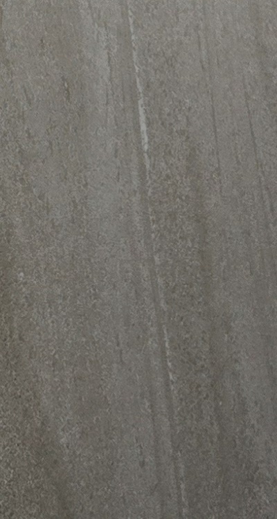 앞니 신경치료 크라운 까지 해야할 상황이라면 관련 이미지 46