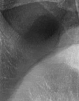 어금니 뒤 잇몸 부음 어떤 문제길래 이런거죠 관련 이미지 19