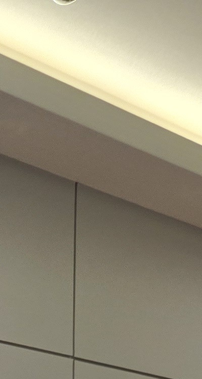 임플란트 뼈이식 안하면 어떤 문제가 있는거죠 관련 이미지 20