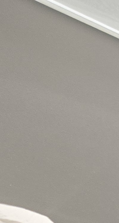 앞니 틀어짐 부분교정 얼마나 걸릴까 관련 이미지 14