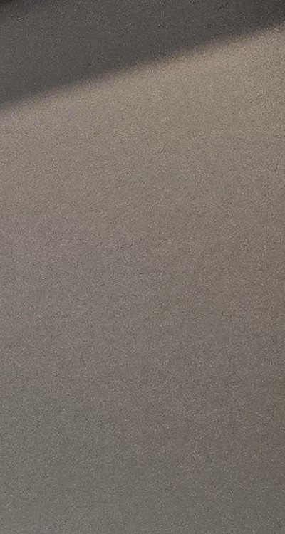 완전매복사랑니 발치 대학병원 꼭 가야하나요 관련 이미지 18