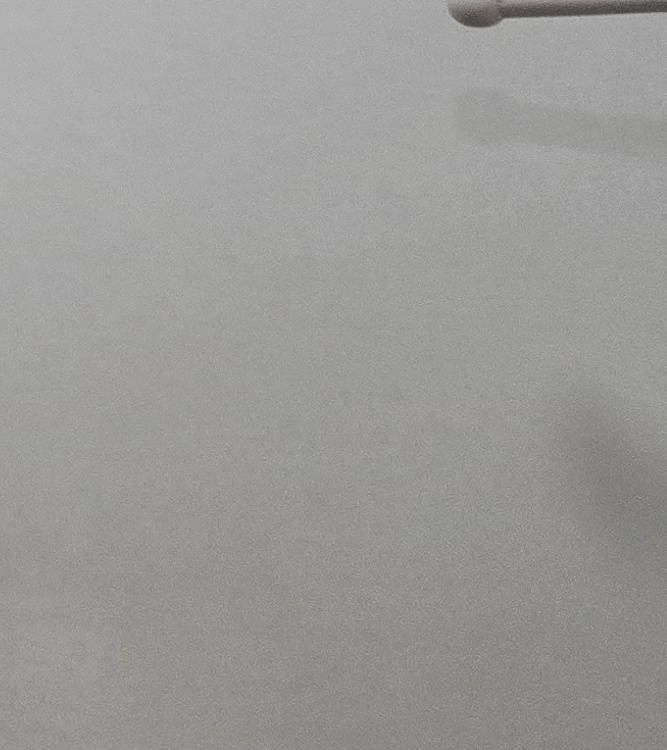 치경부마모증 치료 과정 신중하게 준비하려면 관련 이미지 28