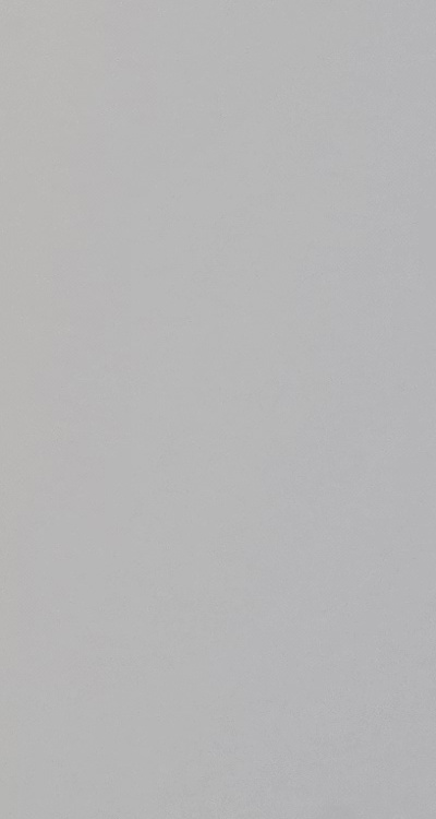 앞니 부분 교정 간단하니까 좋은건가요 관련 이미지 29