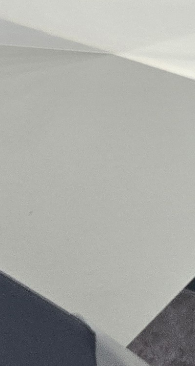 치아 사이 벌어짐 심해지는 이유부터 알아보면 관련 이미지 37