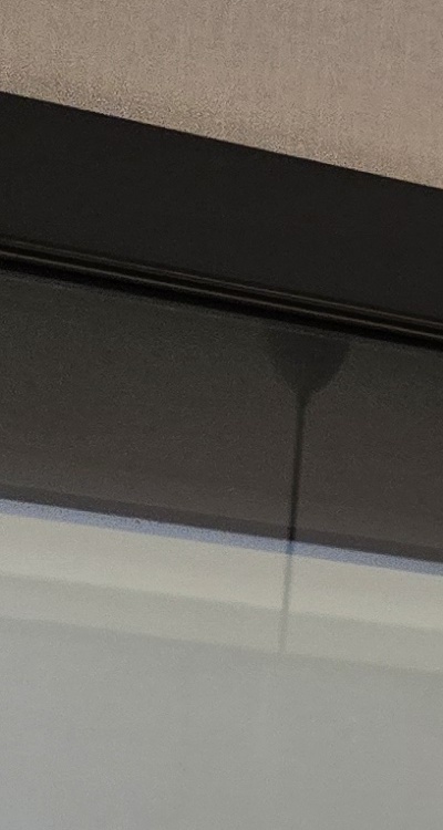 인레이 치료 후 통증 자꾸 심해지는데 괜찮은걸까 관련 이미지 23