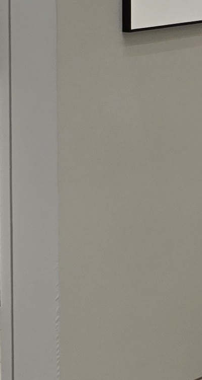 임플란트 뼈이식 안하면 어떤 문제가 있는거죠 관련 이미지 39