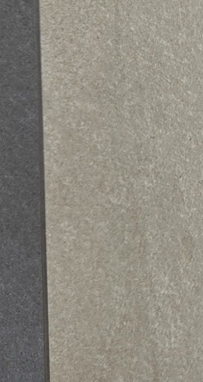 임플란트의 장점 할까 말까 고민이신 분들을 위한 정리 관련 이미지 32