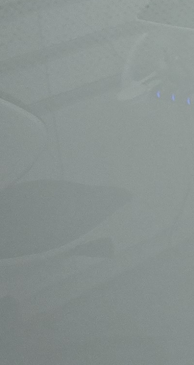 충치 검은점 나타났다면 이렇게 대처해요 관련 이미지 32