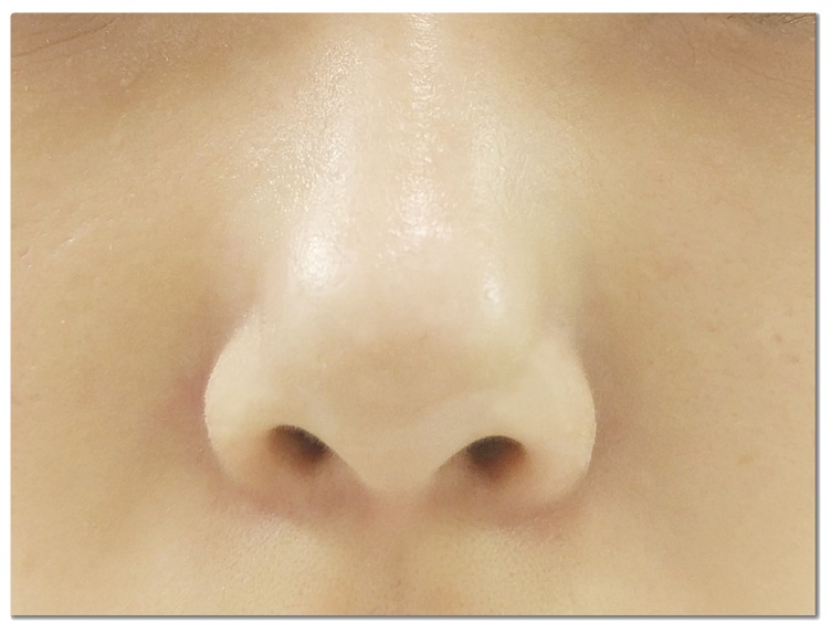 얼굴피지제거 제격이야! 관련 이미지 1