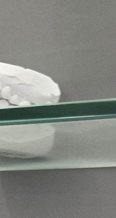 윗니 전체 임플란트 뭐부터 해야할까 관련 이미지 14