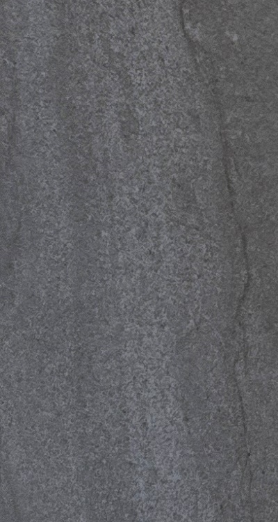 임플란트의 장점 할까 말까 고민이신 분들을 위한 정리 관련 이미지 31