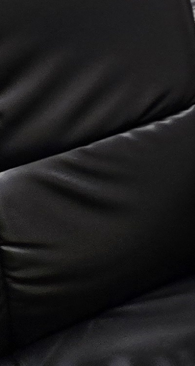 임플란트 뼈이식 안하면 어떤 문제가 있는거죠 관련 이미지 44