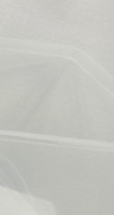 치아 사이 벌어짐 심해지는 이유부터 알아보면 관련 이미지 28