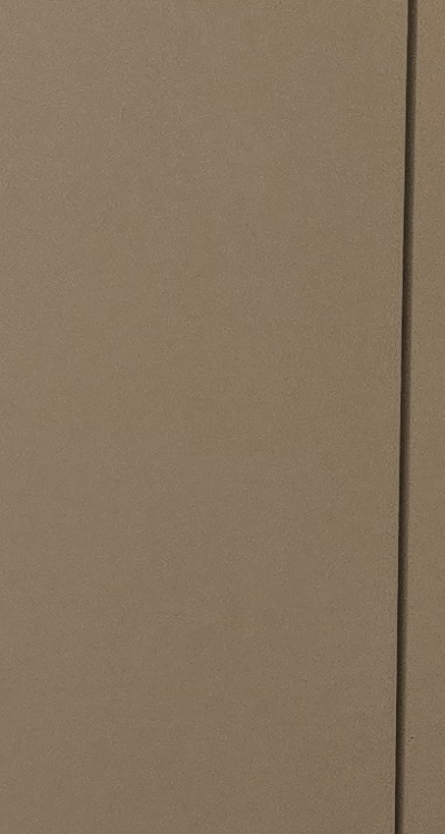 사랑니 발치 후 충치 치료 둘다 준비하려면 관련 이미지 27