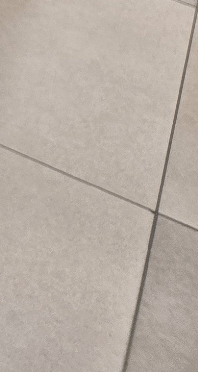 신경치료 아픈가요 망설이시는 분들이라면 관련 이미지 50