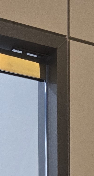 사랑니 발치 후 충치 치료 둘다 준비하려면 관련 이미지 15