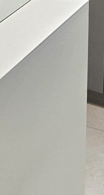 아래 사랑니 발치 통증 미리 알고 대처하려면 관련 이미지 44