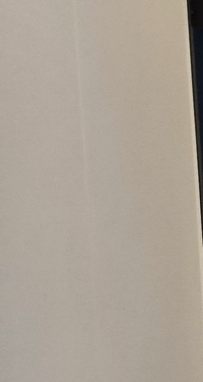 앞니 부분 교정 간단하니까 좋은건가요 관련 이미지 23