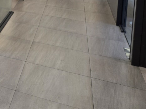 65세이상 임플란트 개수 구체적으로 체크하려면 관련 이미지 27