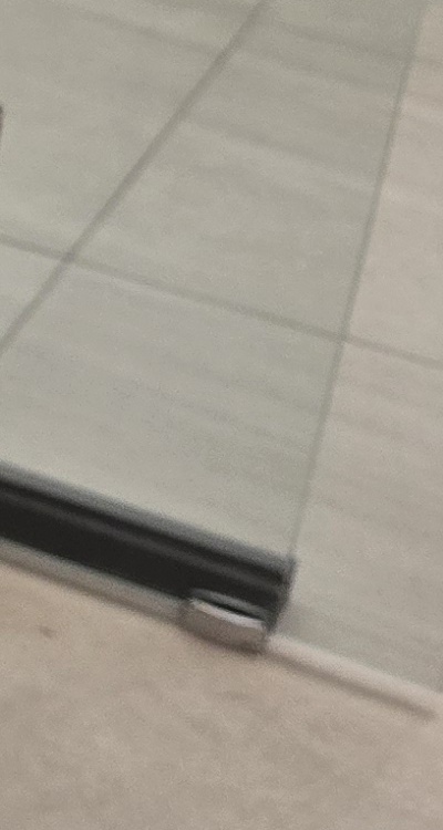 신경치료 아픈가요 망설이시는 분들이라면 관련 이미지 39