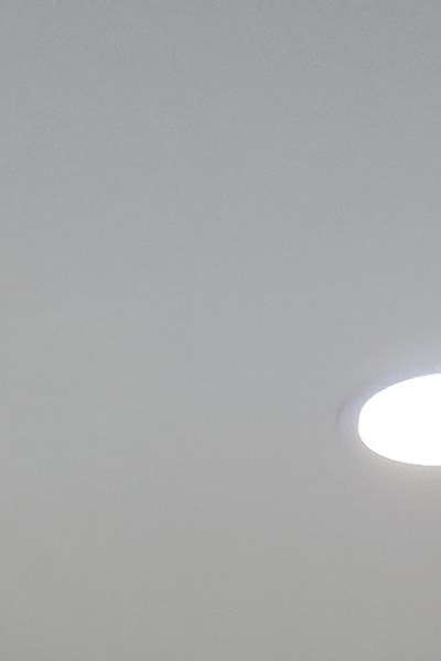 부정교합 교정 안하면 생기는 문제는 뭔가요 관련 이미지 14