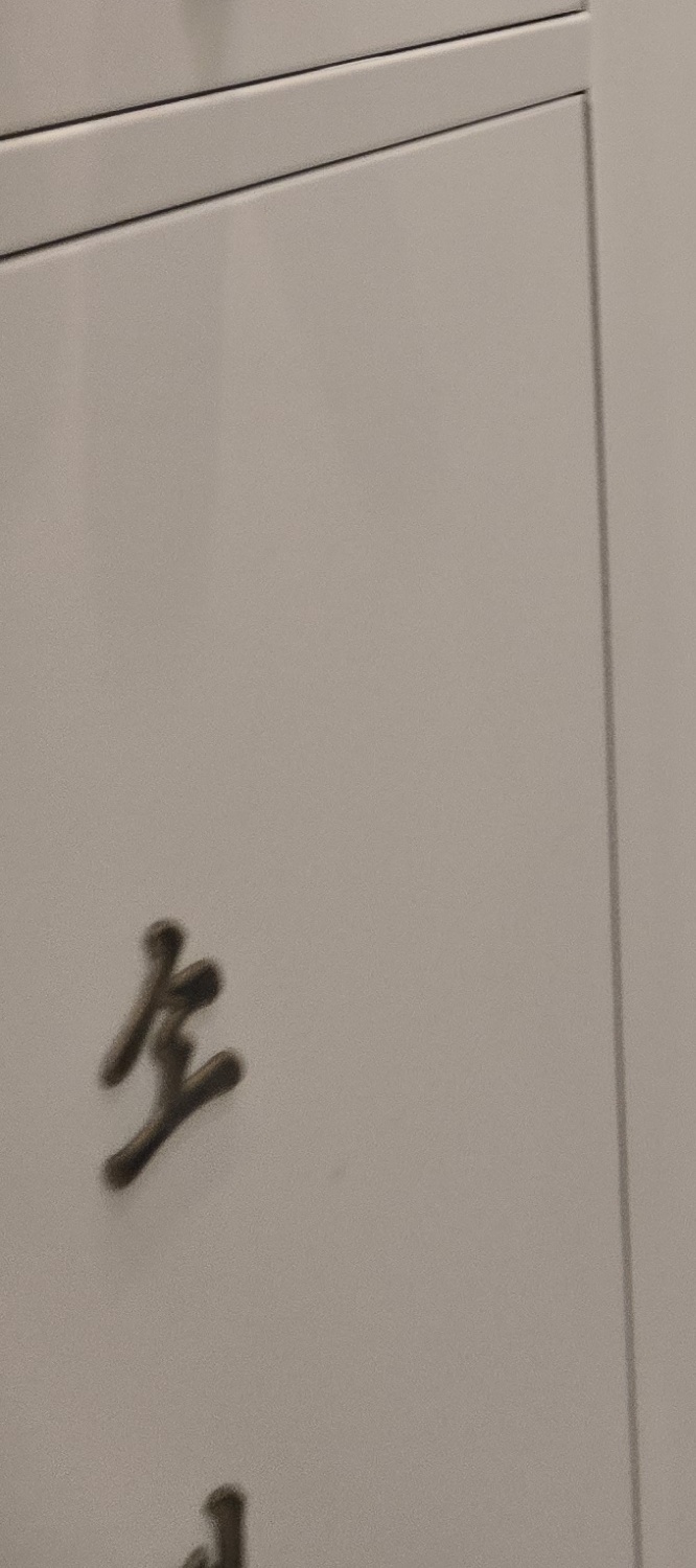 앞니 돌출 교정 기간 자세하게 따져보면 관련 이미지 22